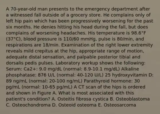 A 70-year-old man presents to the emergency department after a witnessed fall outside of a grocery store. He complains only of left hip pain which has been progressively worsening for the past six months. He denies hitting his head during the fall, but does complains of worsening headaches. His temperature is 98.6°F (37°C), blood pressure is 110/60 mmHg, pulse is 80/min, and respirations are 18/min. Examination of the right lower extremity reveals mild crepitus at the hip, appropriate range of motion, adequate distal sensation, and palpable posterior tibial and dorsalis pedis pulses. Laboratory workup shows the following: Serum: Ca2+: 9.0 mg/dL (normal: 8.9-10.1 mg/dL) Alkaline phosphatase: 876 U/L (normal: 40-120 U/L) 25 hydroxyvitamin D: 89 ng/mL (normal: 20-100 ng/mL) Parathyroid hormone: 30 pg/mL (normal: 10-65 pg/mL) A CT scan of the hips is ordered and shown in Figure A. What is most associated with this patient's condition? A. Osteitis fibrosa cystica B. Osteoblastoma C. Osteochondroma D. Osteoid osteoma E. Osteosarcoma