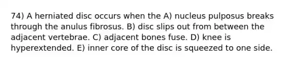 74) A herniated disc occurs when the A) nucleus pulposus breaks through the anulus fibrosus. B) disc slips out from between the adjacent vertebrae. C) adjacent bones fuse. D) knee is hyperextended. E) inner core of the disc is squeezed to one side.