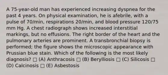 A 75-year-old man has experienced increasing dyspnea for the past 4 years. On physical examination, he is afebrile, with a pulse of 70/min, respirations 20/min, and blood pressure 120/75 mm Hg. A chest radiograph shows increased interstitial markings, but no effusions. The right border of the heart and the pulmonary arteries are prominent. A transbronchial biopsy is performed; the figure shows the microscopic appearance with Prussian blue stain. Which of the following is the most likely diagnosis? □ (A) Anthracosis □ (B) Berylliosis □ (C) Silicosis □ (D) Calcinosis □ (E) Asbestosis