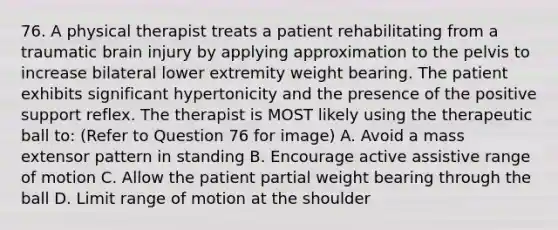 76. A physical therapist treats a patient rehabilitating from a traumatic brain injury by applying approximation to the pelvis to increase bilateral lower extremity weight bearing. The patient exhibits significant hypertonicity and the presence of the positive support reflex. The therapist is MOST likely using the therapeutic ball to: (Refer to Question 76 for image) A. Avoid a mass extensor pattern in standing B. Encourage active assistive range of motion C. Allow the patient partial weight bearing through the ball D. Limit range of motion at the shoulder