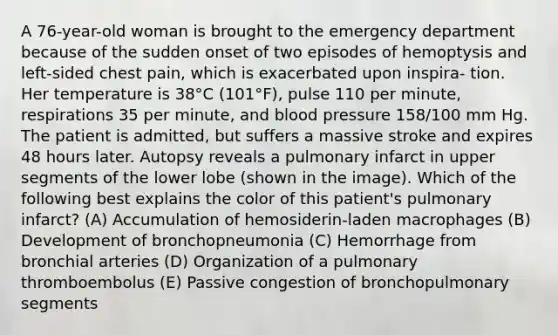 A 76-year-old woman is brought to the emergency department because of the sudden onset of two episodes of hemoptysis and left-sided chest pain, which is exacerbated upon inspira- tion. Her temperature is 38°C (101°F), pulse 110 per minute, respirations 35 per minute, and blood pressure 158/100 mm Hg. The patient is admitted, but suffers a massive stroke and expires 48 hours later. Autopsy reveals a pulmonary infarct in upper segments of the lower lobe (shown in the image). Which of the following best explains the color of this patient's pulmonary infarct? (A) Accumulation of hemosiderin-laden macrophages (B) Development of bronchopneumonia (C) Hemorrhage from bronchial arteries (D) Organization of a pulmonary thromboembolus (E) Passive congestion of bronchopulmonary segments