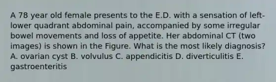 A 78 year old female presents to the E.D. with a sensation of left-lower quadrant abdominal pain, accompanied by some irregular bowel movements and loss of appetite. Her abdominal CT (two images) is shown in the Figure. What is the most likely diagnosis? A. ovarian cyst B. volvulus C. appendicitis D. diverticulitis E. gastroenteritis