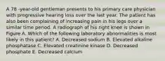 A 78 -year-old gentleman presents to his primary care physician with progressive hearing loss over the last year. The patient has also been complaining of increasing pain in his legs over a similar time period. A radiograph of his right knee is shown in Figure A. Which of the following laboratory abnormalities is most likely in this patient? A. Decreased sodium B. Elevated alkaline phosphatase C. Elevated creatinine kinase D. Decreased phosphate E. Decreased calcium