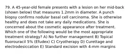 79. A 45-year-old female presents with a lesion on her mid-back (shown below) that measures 1.2mm in diameter. A punch biopsy confirms nodular basal cell carcinoma. She is otherwise healthy and does not take any daily medications. She is concerned about the cosmetic appearance after treatment. Which one of the following would be the most appropriate treatment strategy? A) No further management B) Topical fluorouracil 5% (Efudex) C) Cryotherapy D) Curettage and electrodesiccation E) Standard excision with 4-mm margins