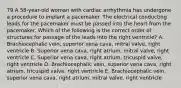 79 A 58-year-old woman with cardiac arrhythmia has undergone a procedure to implant a pacemaker. The electrical conducting leads for the pacemaker must be passed into the heart from the pacemaker. Which of the following is the correct order of structures for passage of the leads into the right ventricle? A. Brachiocephalic vein, superior vena cava, mitral valve, right ventricle B. Superior vena cava, right atrium, mitral valve, right ventricle C. Superior vena cava, right atrium, tricuspid valve, right ventricle D. Brachiocephalic vein, superior vena cava, right atrium, tricuspid valve, right ventricle E. Brachiocephalic vein, superior vena cava, right atrium, mitral valve, right ventricle