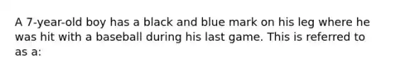 A 7-year-old boy has a black and blue mark on his leg where he was hit with a baseball during his last game. This is referred to as a: