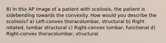 8) In this AP image of a patient with scoliosis, the patient is sidebending towards the convexity. How would you describe the scoliosis? a) Left-convex thoracolumbar, structural b) Right rotated, lumbar structural c) Right-convex lumbar, functional d) Right-convex thoracolumbar, structural