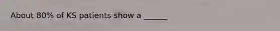 About 80% of KS patients show a ______