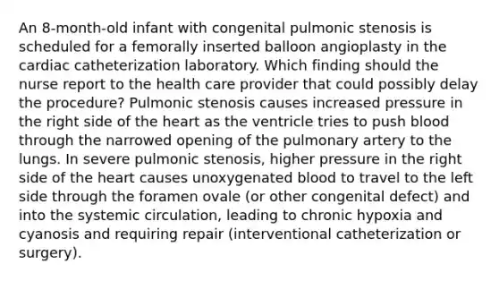 An 8-month-old infant with congenital pulmonic stenosis is scheduled for a femorally inserted balloon angioplasty in the cardiac catheterization laboratory. Which finding should the nurse report to the health care provider that could possibly delay the procedure? Pulmonic stenosis causes increased pressure in the right side of the heart as the ventricle tries to push blood through the narrowed opening of the pulmonary artery to the lungs. In severe pulmonic stenosis, higher pressure in the right side of the heart causes unoxygenated blood to travel to the left side through the foramen ovale (or other congenital defect) and into the systemic circulation, leading to chronic hypoxia and cyanosis and requiring repair (interventional catheterization or surgery).