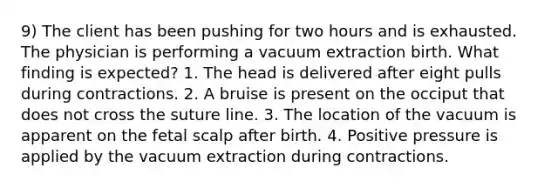 9) The client has been pushing for two hours and is exhausted. The physician is performing a vacuum extraction birth. What finding is expected? 1. The head is delivered after eight pulls during contractions. 2. A bruise is present on the occiput that does not cross the suture line. 3. The location of the vacuum is apparent on the fetal scalp after birth. 4. Positive pressure is applied by the vacuum extraction during contractions.