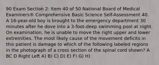 90 Exam Section 2: Item 40 of 50 National Board of Medical Examiners® Comprehensive Basic Science Self-Assessment 40. A 16-year-old boy is brought to the emergency department 30 minutes after he dove into a 3-foot-deep swimming pool at night. On examination, he is unable to move the right upper and lower extremities. The most likely cause of the movement deficits in this patient is damage to which of the following labeled regions in the photograph of a cross section of the spinal cord shown? A BC D Right Left A) B) C) D) E) F) G) H)