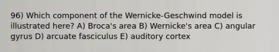 96) Which component of the Wernicke-Geschwind model is illustrated here? A) Broca's area B) Wernicke's area C) angular gyrus D) arcuate fasciculus E) auditory cortex