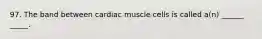 97. The band between cardiac muscle cells is called a(n) ______ _____.