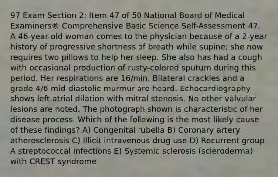 97 Exam Section 2: Item 47 of 50 National Board of Medical Examiners® Comprehensive Basic Science Self-Assessment 47. A 46-year-old woman comes to the physician because of a 2-year history of progressive shortness of breath while supine; she now requires two pillows to help her sleep. She also has had a cough with occasional production of rusty-colored sputum during this period. Her respirations are 16/min. Bilateral crackles and a grade 4/6 mid-diastolic murmur are heard. Echocardiography shows left atrial dilation with mitral stenosis. No other valvular lesions are noted. The photograph shown is characteristic of her disease process. Which of the following is the most likely cause of these findings? A) Congenital rubella B) Coronary artery atherosclerosis C) Illicit intravenous drug use D) Recurrent group A streptococcal infections E) Systemic sclerosis (scleroderma) with CREST syndrome