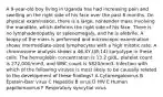 A 9-year-old boy living in Uganda has had increasing pain and swelling on the right side of his face over the past 8 months. On physical examination, there is a large, nontender mass involving the mandible, which deforms the right side of his face. There is no lymphadenopathy or splenomegaly, and he is afebrile. A biopsy of the mass is performed and microscopic examination shows intermediate-sized lymphocytes with a high mitotic rate. A chromosome analysis shows a 46,XY,t(8;14) karyotype in these cells. The hemoglobin concentration is 13.2 g/dL, platelet count is 272,000/mm3, and WBC count is 5820/mm3. Infection with which of the following viruses is most likely to be causally related to the development of these findings? A Cytomegalovirus B Epstein-Barr virus C Hepatitis B virus D HIV E Human papillomavirus F Respiratory syncytial virus