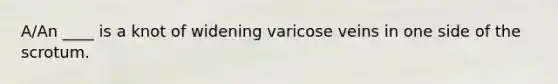 A/An ____ is a knot of widening varicose veins in one side of the scrotum.