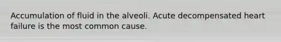 Accumulation of fluid in the alveoli. Acute decompensated heart failure is the most common cause.