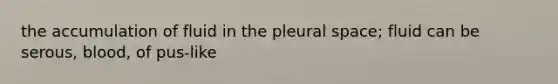 the accumulation of fluid in the pleural space; fluid can be serous, blood, of pus-like