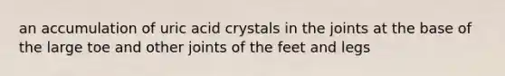 an accumulation of uric acid crystals in the joints at the base of the large toe and other joints of the feet and legs