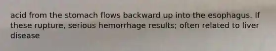 acid from the stomach flows backward up into the esophagus. If these rupture, serious hemorrhage results; often related to liver disease
