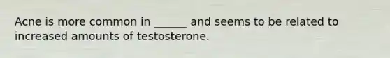 Acne is more common in ______ and seems to be related to increased amounts of testosterone.