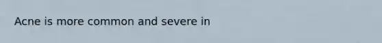 Acne is more common and severe in