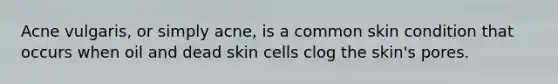 Acne vulgaris, or simply acne, is a common skin condition that occurs when oil and dead skin cells clog the skin's pores.