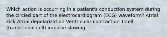 Which action is occurring in a patient's conduction system during the circled part of the electrocardiogram (ECG) waveform? Atrial kick Atrial depolarization Ventricular contraction T-cell (transitional cell) impulse slowing