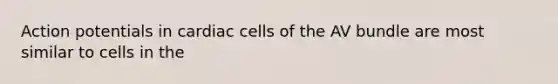 Action potentials in cardiac cells of the AV bundle are most similar to cells in the