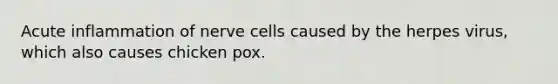 Acute inflammation of nerve cells caused by the herpes virus, which also causes chicken pox.