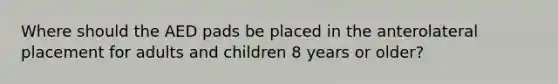 Where should the AED pads be placed in the anterolateral placement for adults and children 8 years or older?