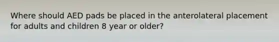 Where should AED pads be placed in the anterolateral placement for adults and children 8 year or older?