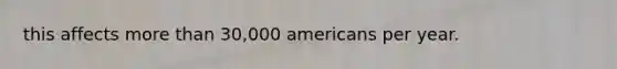 this affects more than 30,000 americans per year.