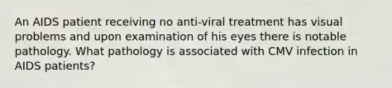 An AIDS patient receiving no anti-viral treatment has visual problems and upon examination of his eyes there is notable pathology. What pathology is associated with CMV infection in AIDS patients?