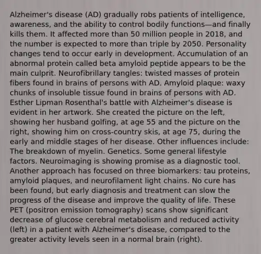 Alzheimer's disease (AD) gradually robs patients of intelligence, awareness, and the ability to control bodily functions—and finally kills them. It affected more than 50 million people in 2018, and the number is expected to more than triple by 2050. Personality changes tend to occur early in development. Accumulation of an abnormal protein called beta amyloid peptide appears to be the main culprit. Neurofibrillary tangles: twisted masses of protein fibers found in brains of persons with AD. Amyloid plaque: waxy chunks of insoluble tissue found in brains of persons with AD. Esther Lipman Rosenthal's battle with Alzheimer's disease is evident in her artwork. She created the picture on the left, showing her husband golfing, at age 55 and the picture on the right, showing him on cross-country skis, at age 75, during the early and middle stages of her disease. Other influences include: The breakdown of myelin. Genetics. Some general lifestyle factors. Neuroimaging is showing promise as a diagnostic tool. Another approach has focused on three biomarkers: tau proteins, amyloid plaques, and neurofilament light chains. No cure has been found, but early diagnosis and treatment can slow the progress of the disease and improve the quality of life. These PET (positron emission tomography) scans show significant decrease of glucose cerebral metabolism and reduced activity (left) in a patient with Alzheimer's disease, compared to the greater activity levels seen in a normal brain (right).