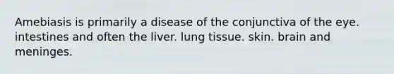 Amebiasis is primarily a disease of the conjunctiva of the eye. intestines and often the liver. lung tissue. skin. brain and meninges.