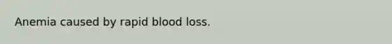 Anemia caused by rapid blood loss.