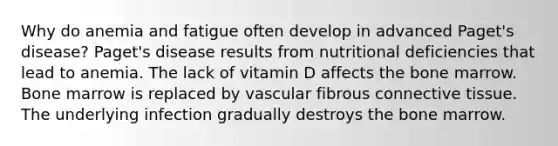 Why do anemia and fatigue often develop in advanced Paget's disease? Paget's disease results from nutritional deficiencies that lead to anemia. The lack of vitamin D affects the bone marrow. Bone marrow is replaced by vascular fibrous connective tissue. The underlying infection gradually destroys the bone marrow.