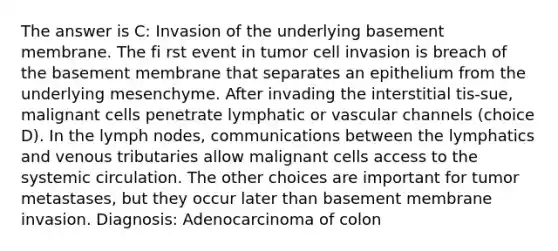 The answer is C: Invasion of the underlying basement membrane. The fi rst event in tumor cell invasion is breach of the basement membrane that separates an epithelium from the underlying mesenchyme. After invading the interstitial tis-sue, malignant cells penetrate lymphatic or vascular channels (choice D). In the lymph nodes, communications between the lymphatics and venous tributaries allow malignant cells access to the systemic circulation. The other choices are important for tumor metastases, but they occur later than basement membrane invasion. Diagnosis: Adenocarcinoma of colon