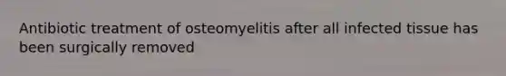 Antibiotic treatment of osteomyelitis after all infected tissue has been surgically removed