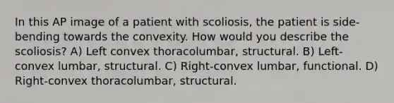 In this AP image of a patient with scoliosis, the patient is side-bending towards the convexity. How would you describe the scoliosis? A) Left convex thoracolumbar, structural. B) Left-convex lumbar, structural. C) Right-convex lumbar, functional. D) Right-convex thoracolumbar, structural.