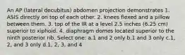 An AP (lateral decubitus) abdomen projection demonstrates 1. ASIS directly on top of each other. 2. knees flexed and a pillow between them. 3. top of the IR at a level 2.5 inches (6.25 cm) superior to xiphoid. 4. diaphragm domes located superior to the ninth posterior rib. Select one: a.1 and 2 only b.1 and 3 only c.1, 2, and 3 only d.1, 2, 3, and 4