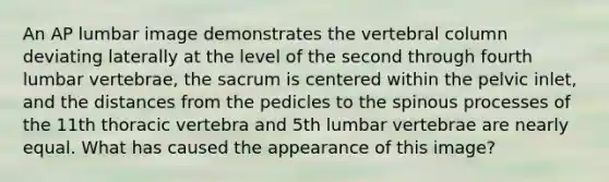 An AP lumbar image demonstrates the vertebral column deviating laterally at the level of the second through fourth lumbar vertebrae, the sacrum is centered within the pelvic inlet, and the distances from the pedicles to the spinous processes of the 11th thoracic vertebra and 5th lumbar vertebrae are nearly equal. What has caused the appearance of this image?