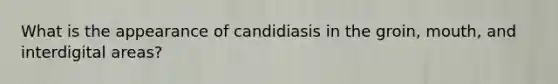 What is the appearance of candidiasis in the groin, mouth, and interdigital areas?