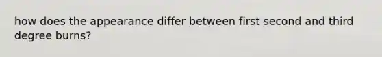 how does the appearance differ between first second and third degree burns?