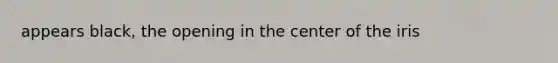 appears black, the opening in the center of the iris