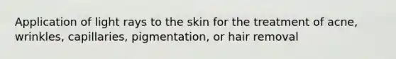 Application of light rays to the skin for the treatment of acne, wrinkles, capillaries, pigmentation, or hair removal