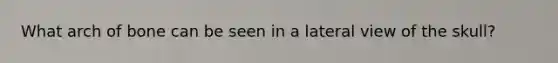 What arch of bone can be seen in a lateral view of the skull?