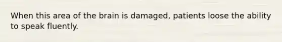 When this area of the brain is damaged, patients loose the ability to speak fluently.