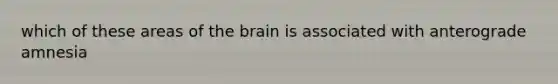 which of these areas of the brain is associated with anterograde amnesia